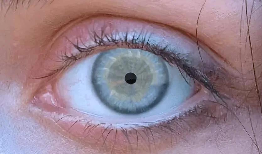 маленькие зраки глаза от наркотиков.webp