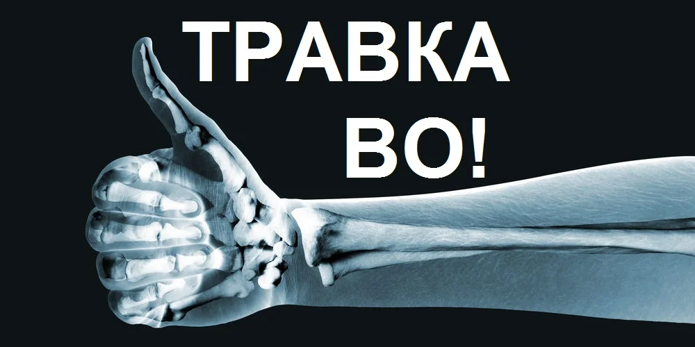 ревматология и медицинский_каннабис.webp