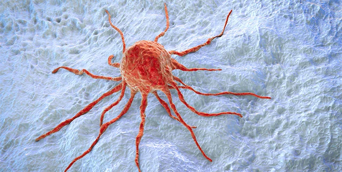 вторичный рак.webp